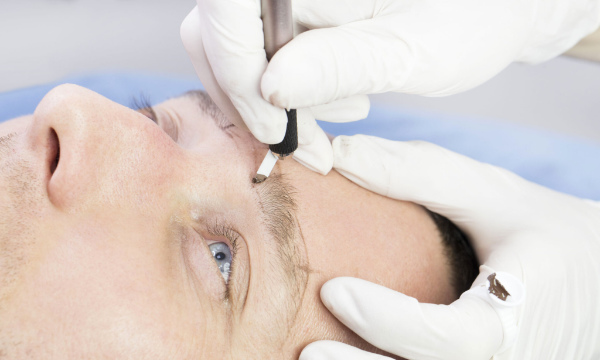 men-microblading-treatment-jadore-my-skin